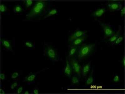 Immunocytochemistry/ Immunofluorescence: RPL9 Antibody (2F11) [H00006133-M01]
