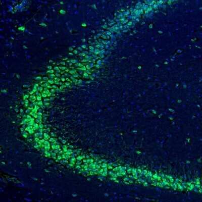 Immunohistochemistry: RPL9 Antibody [NBP1-82853]