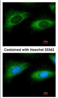 Immunocytochemistry/ Immunofluorescence: RPL9 Antibody [NBP2-20219]