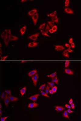 Immunocytochemistry/ Immunofluorescence: RPL9 Antibody - BSA Free [NBP2-93947]