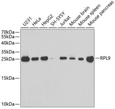 Western Blot: RPL9 AntibodyBSA Free [NBP2-94567]