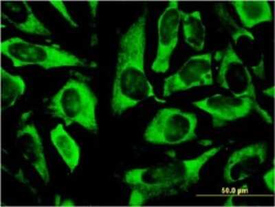 Immunocytochemistry/ Immunofluorescence: RPLP0 Antibody (1B4) [H00006175-M01]