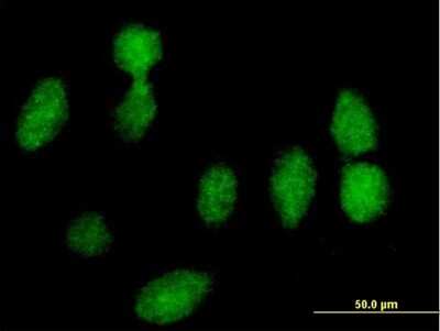 Immunocytochemistry/ Immunofluorescence: RPLP0 Antibody [H00006175-B01P]