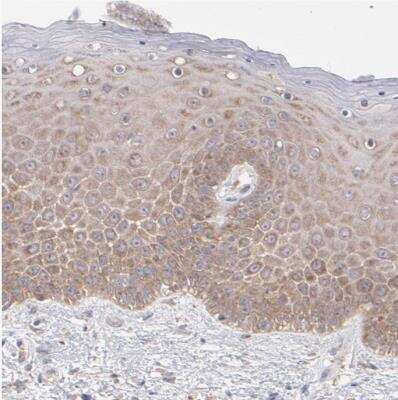Immunohistochemistry-Paraffin: RPLP0 Antibody [NBP1-82859]