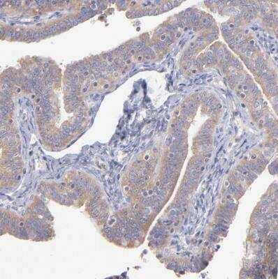 Immunohistochemistry-Paraffin: RPLP0 Antibody [NBP1-82859]