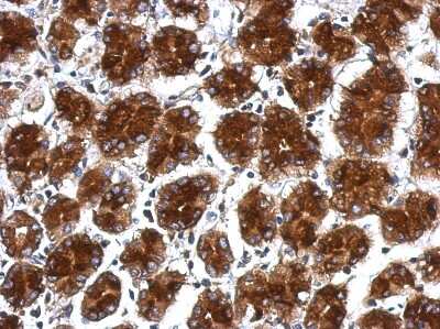 Immunohistochemistry-Paraffin: RPLP0 Antibody [NBP2-20220]