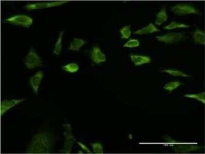Immunocytochemistry/ Immunofluorescence: RPLP1 Antibody (1G10) [H00006176-M01]