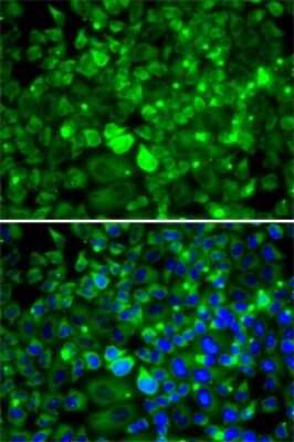 Immunocytochemistry/ Immunofluorescence: RPLP1 Antibody - BSA Free [NBP2-94116]