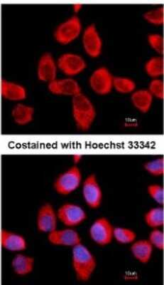 Immunocytochemistry/ Immunofluorescence: RPLP2 Antibody [NBP2-15104]