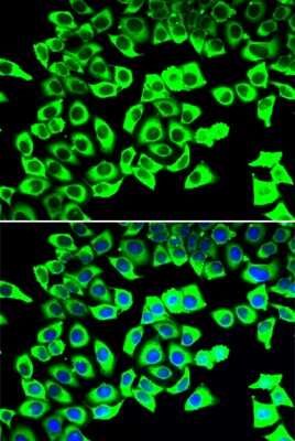Immunocytochemistry/ Immunofluorescence: RPLP2 Antibody - BSA Free [NBP3-04413]