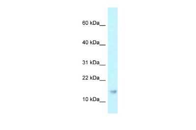 Western Blot: RPP21 Antibody [NBP2-84253]