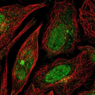 Immunocytochemistry/ Immunofluorescence: RPP25 Antibody [NBP1-92349]