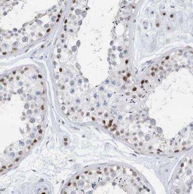 Immunohistochemistry-Paraffin: RPP30 Antibody [NBP1-80658]