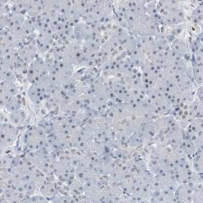 Immunohistochemistry-Paraffin: RPP30 Antibody [NBP1-80658]