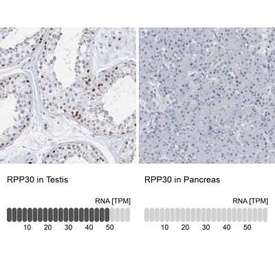 Immunohistochemistry-Paraffin: RPP30 Antibody [NBP1-80658]
