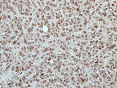Immunohistochemistry-Paraffin: RPP30 Antibody [NBP2-20221]