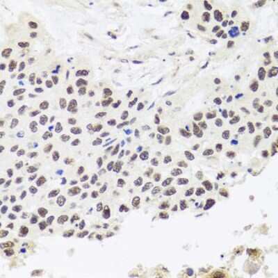 Immunohistochemistry-Paraffin: RPP30 Antibody - BSA Free [NBP2-94695]