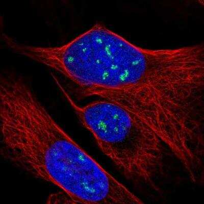 Immunocytochemistry/ Immunofluorescence: RPP38 Antibody [NBP2-13260]