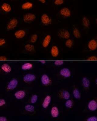 Immunocytochemistry/ Immunofluorescence: RPP38 Antibody - Azide and BSA Free [NBP2-94050]