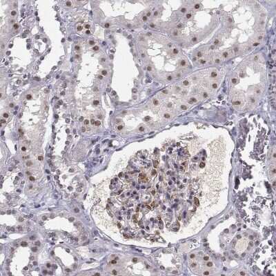 Immunohistochemistry: RPP38 Antibody [NBP2-68691]