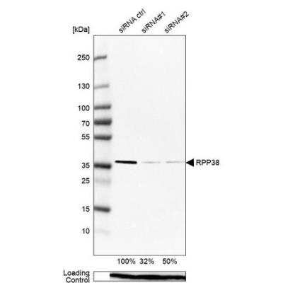 Western Blot: RPP38 Antibody [NBP2-13260]