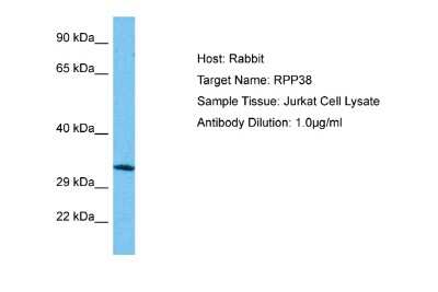 Western Blot: RPP38 Antibody [NBP2-85664]