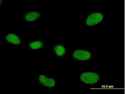 Immunocytochemistry/ Immunofluorescence: RPP40 Antibody [H00010799-B01P]