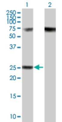 Western Blot: RPP40 Antibody [H00010799-B01P]