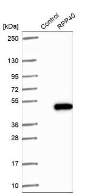 Western Blot: RPP40 Antibody [NBP1-88765]