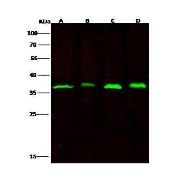Western Blot: RPRD1B Antibody (01) [NBP3-06202]