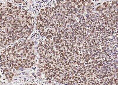 Immunohistochemistry-Paraffin: RPRD1B Antibody (08) [NBP3-06521]