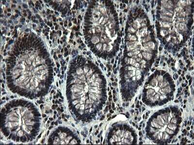 Immunohistochemistry: RPRD1B Antibody (OTI1C7) [NBP2-45634]