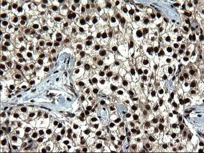 Immunohistochemistry: RPRD1B Antibody (OTI1C7) [NBP2-45634]
