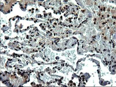 Immunohistochemistry: RPRD1B Antibody (OTI1C7) [NBP2-45634]