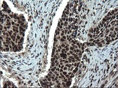 Immunohistochemistry: RPRD1B Antibody (OTI1C7) [NBP2-45634]
