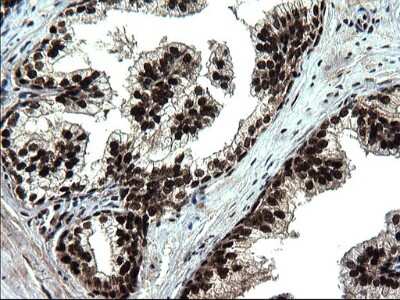 Immunohistochemistry: RPRD1B Antibody (OTI1C7) [NBP2-45634]
