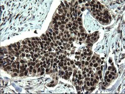 Immunohistochemistry: RPRD1B Antibody (OTI1C7) [NBP2-45634]