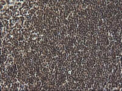 Immunohistochemistry: RPRD1B Antibody (OTI1C7) [NBP2-45634]
