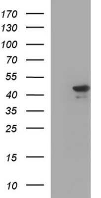 Western Blot: RPRD1B Antibody (OTI1C7) [NBP2-45634]