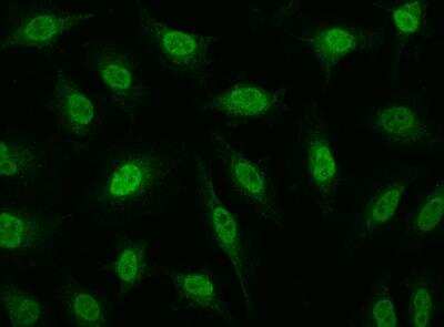 Immunocytochemistry/ Immunofluorescence: RPRD1B Antibody [NBP3-12539]