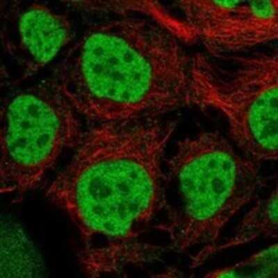 Immunocytochemistry/ Immunofluorescence: RPRD1B Antibody [NBP3-17643]