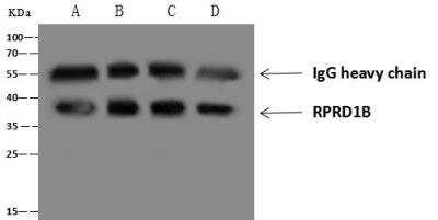 Immunoprecipitation: RPRD1B Antibody [NBP3-12539]