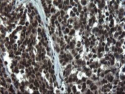 Immunohistochemistry: RPRD1B Antibody (OTI1C7) - Azide and BSA Free [NBP2-73945]