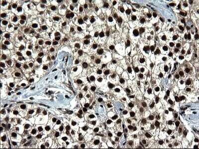 Immunohistochemistry: RPRD1B Antibody (OTI1C7) - Azide and BSA Free [NBP2-73945]
