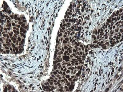 Immunohistochemistry: RPRD1B Antibody (OTI1C7) - Azide and BSA Free [NBP2-73945]