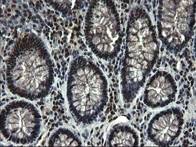 Immunohistochemistry: RPRD1B Antibody (OTI1C7) - Azide and BSA Free [NBP2-73945]