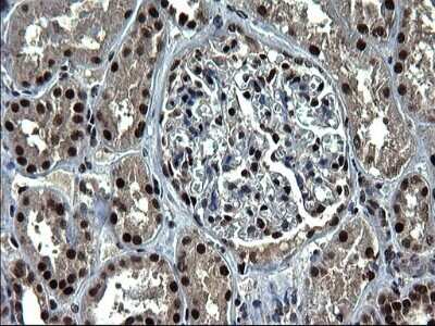 Immunohistochemistry: RPRD1B Antibody (OTI1C7) - Azide and BSA Free [NBP2-73945]