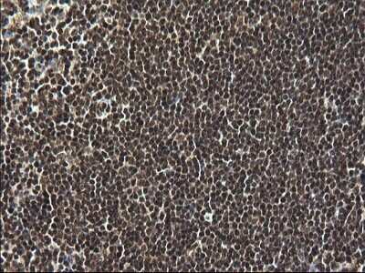 Immunohistochemistry: RPRD1B Antibody (OTI1C7) - Azide and BSA Free [NBP2-73945]
