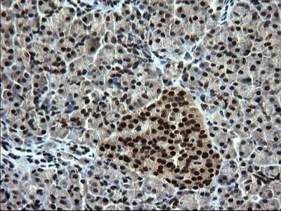 Immunohistochemistry: RPRD1B Antibody (OTI1C7) - Azide and BSA Free [NBP2-73945]
