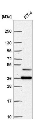 Western Blot: RPRD1B Antibody [NBP2-55788]